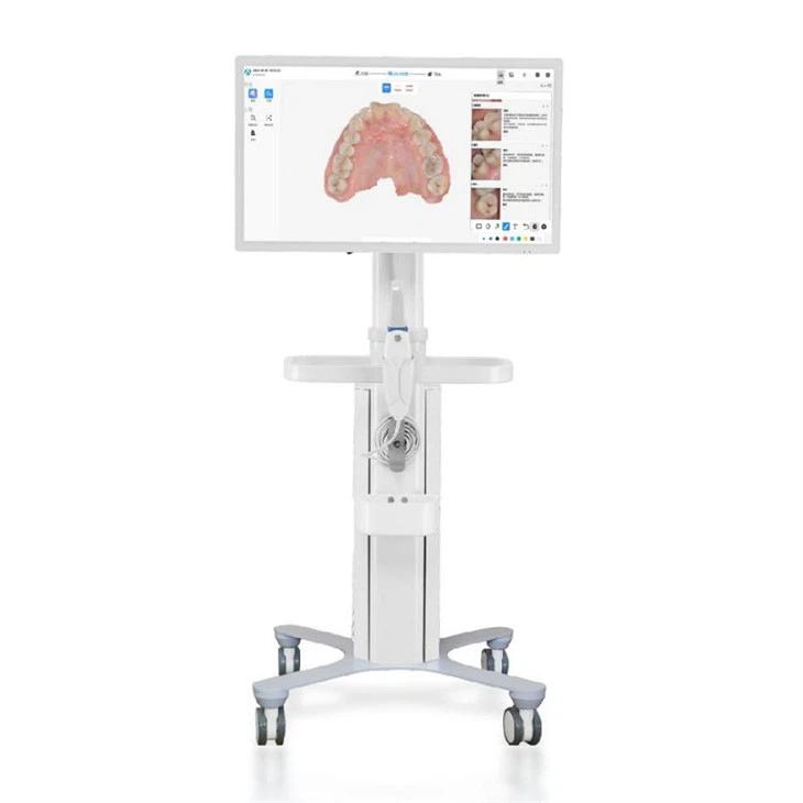 dental-intraoral-scanner6a371